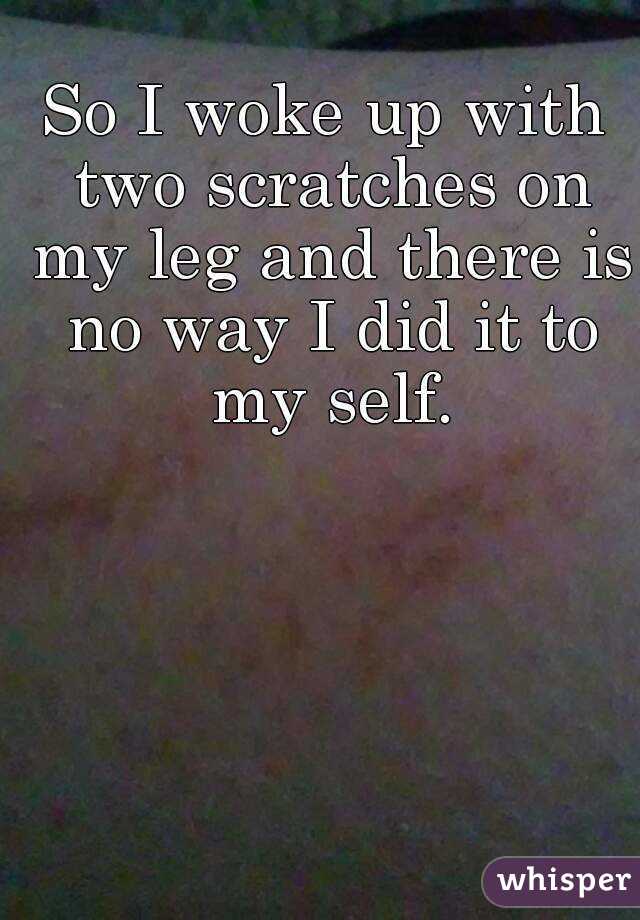 So I woke up with two scratches on my leg and there is no way I did it to my self.
