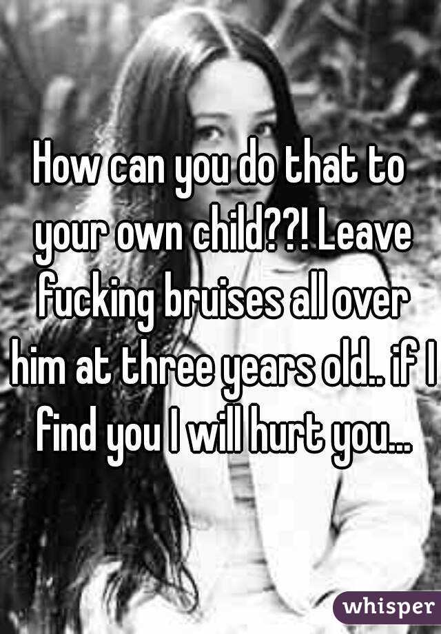How can you do that to your own child??! Leave fucking bruises all over him at three years old.. if I find you I will hurt you...