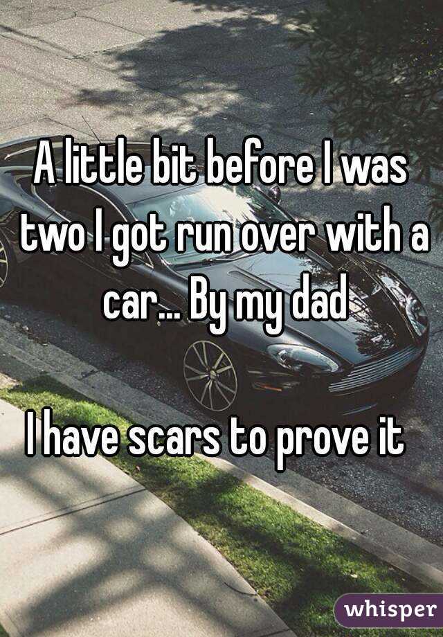 A little bit before I was two I got run over with a car... By my dad

I have scars to prove it 