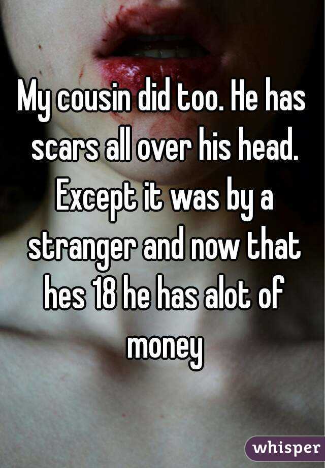 My cousin did too. He has scars all over his head. Except it was by a stranger and now that hes 18 he has alot of money