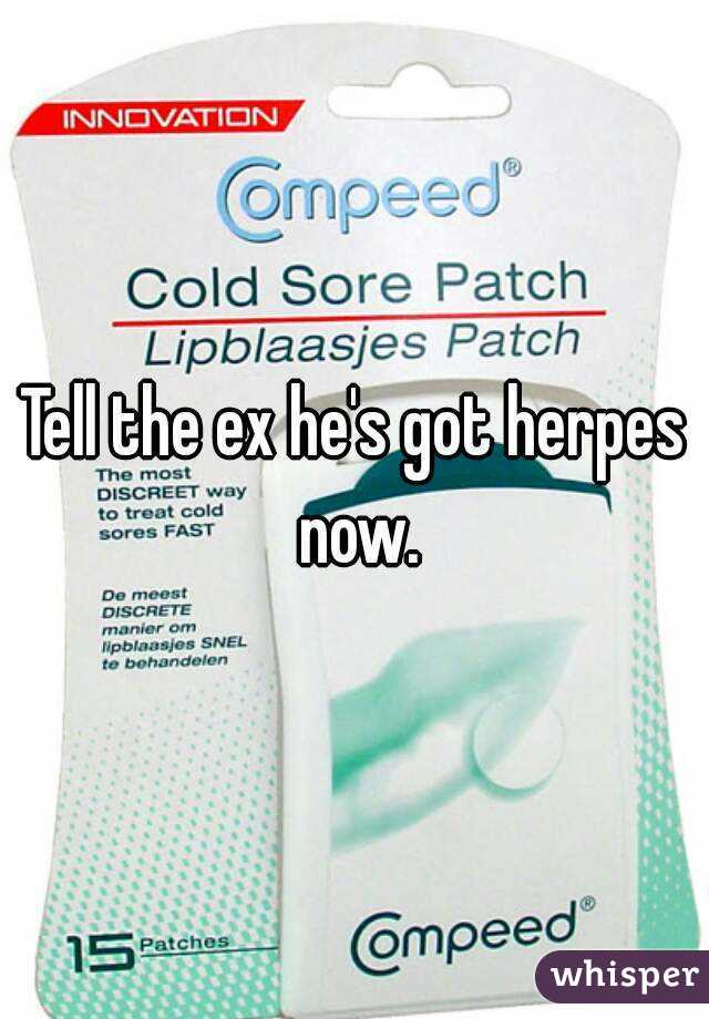 Tell The Ex Hes Got Herpes Now