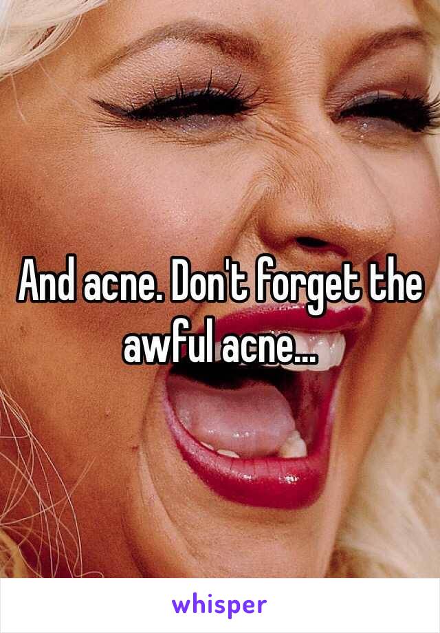 And acne. Don't forget the awful acne... 