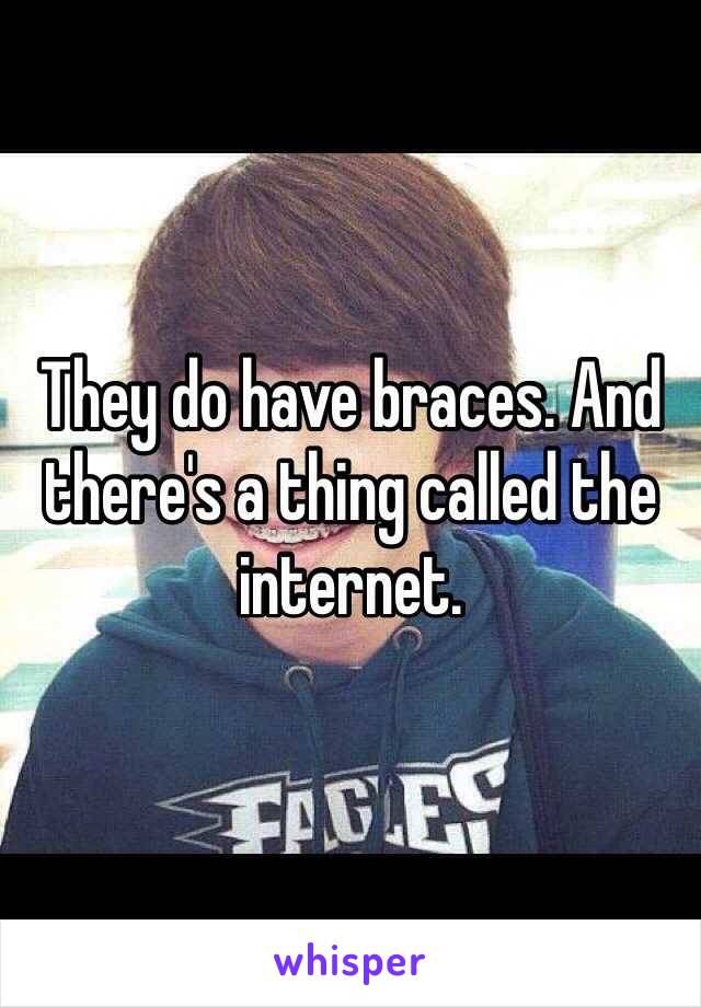 They do have braces. And there's a thing called the internet. 