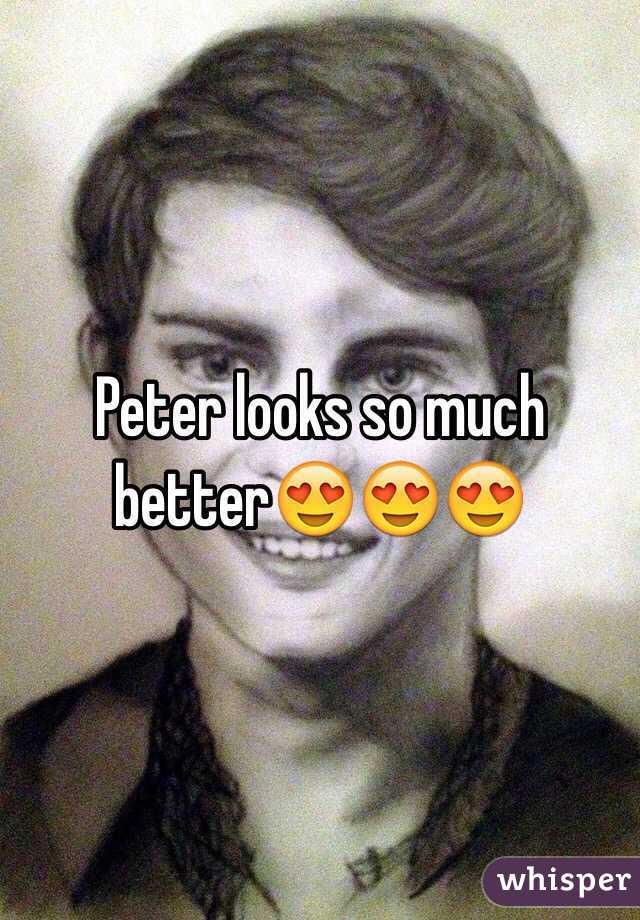 Peter looks so much better😍😍😍