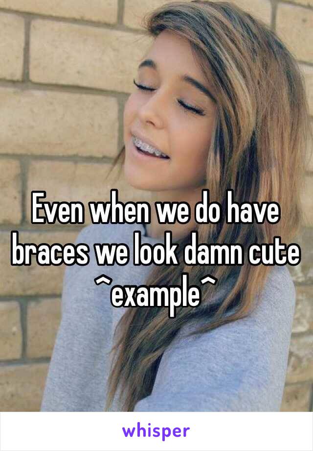 Even when we do have braces we look damn cute 
^example^