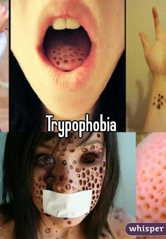 Trypophobia