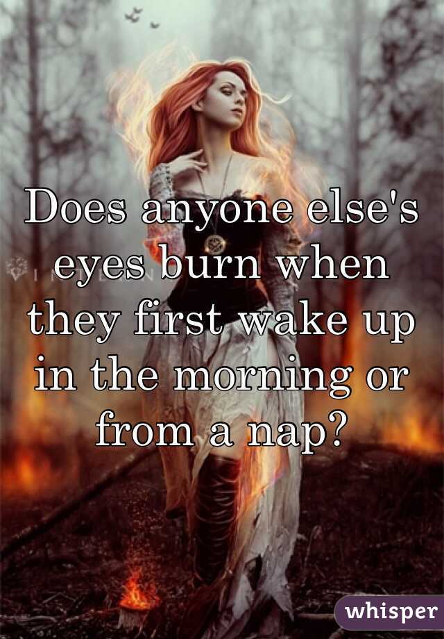 Does anyone else's eyes burn when they first wake up in the morning or from a nap?