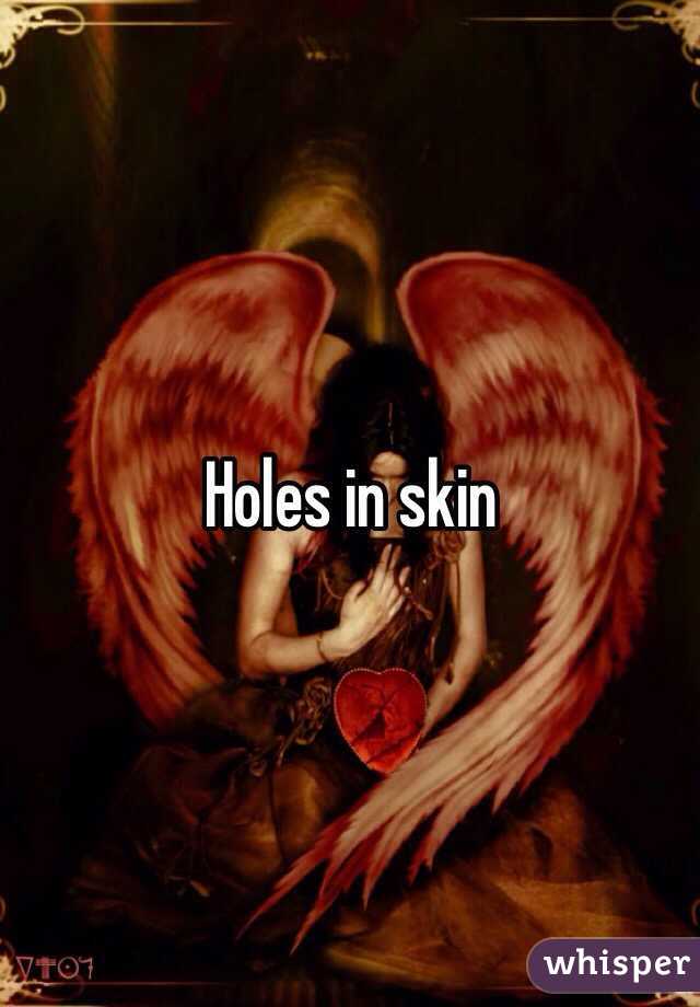 Holes in skin