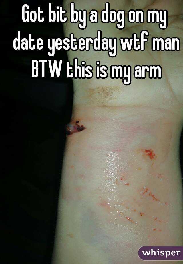 Got bit by a dog on my date yesterday wtf man BTW this is my arm