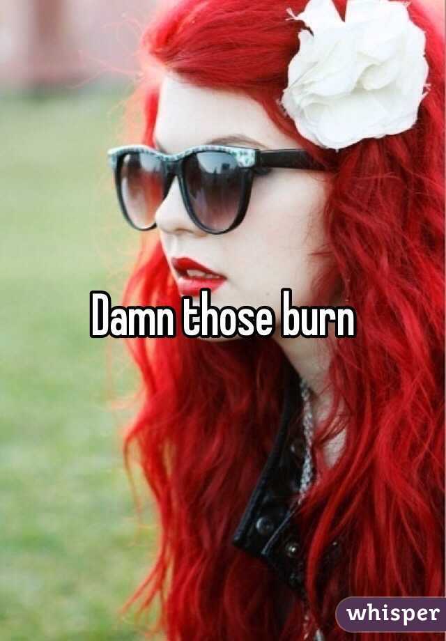 Damn those burn 