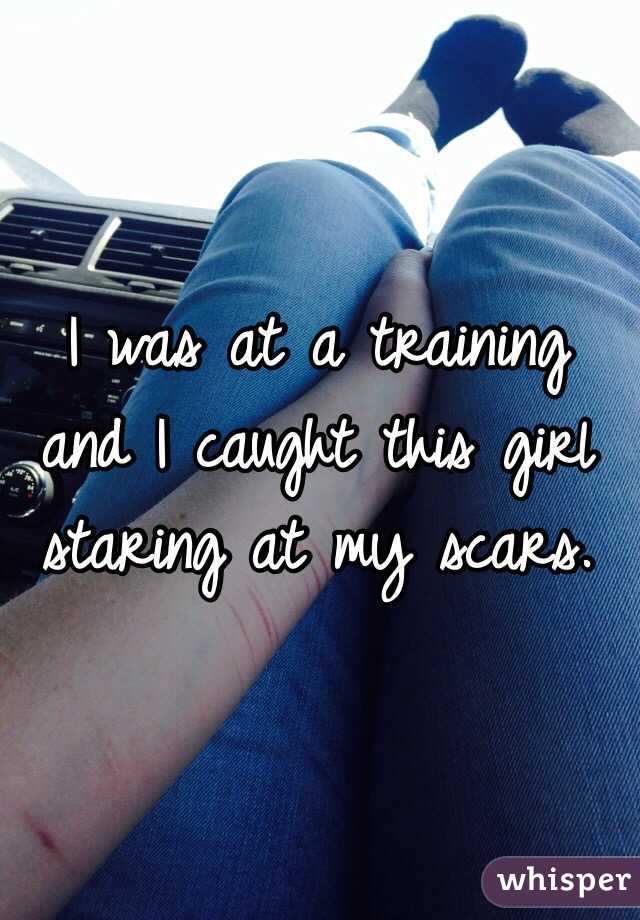 I was at a training and I caught this girl staring at my scars.