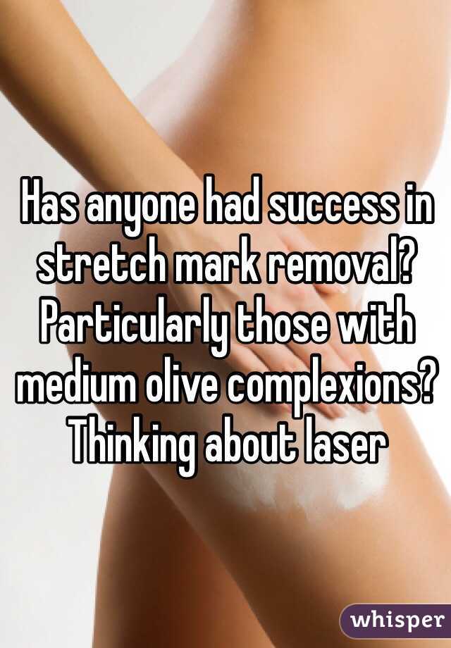 Has anyone had success in stretch mark removal? Particularly those with medium olive complexions? Thinking about laser