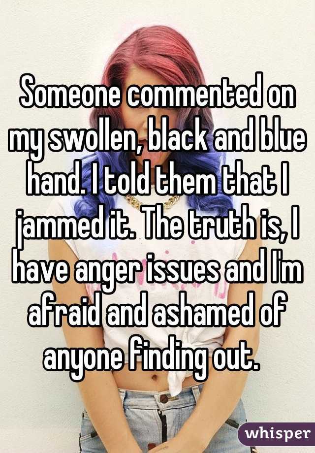 Someone commented on my swollen, black and blue hand. I told them that I jammed it. The truth is, I have anger issues and I'm afraid and ashamed of anyone finding out.  