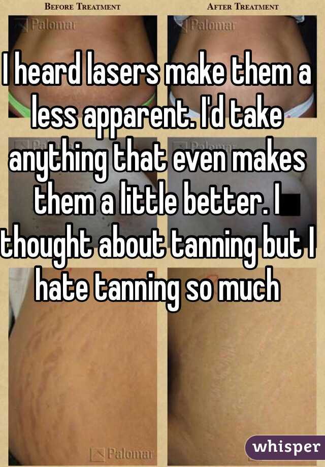 I heard lasers make them a less apparent. I'd take anything that even makes them a little better. I thought about tanning but I hate tanning so much
