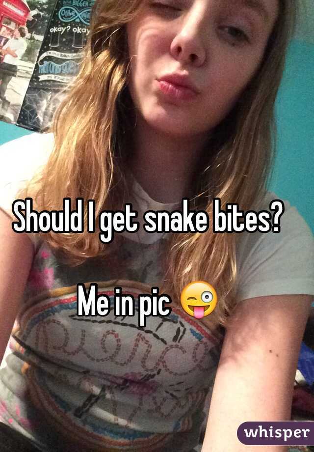 Should I get snake bites?

Me in pic 😜