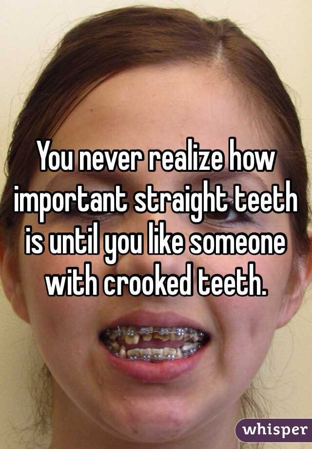 You never realize how important straight teeth is until you like someone with crooked teeth. 