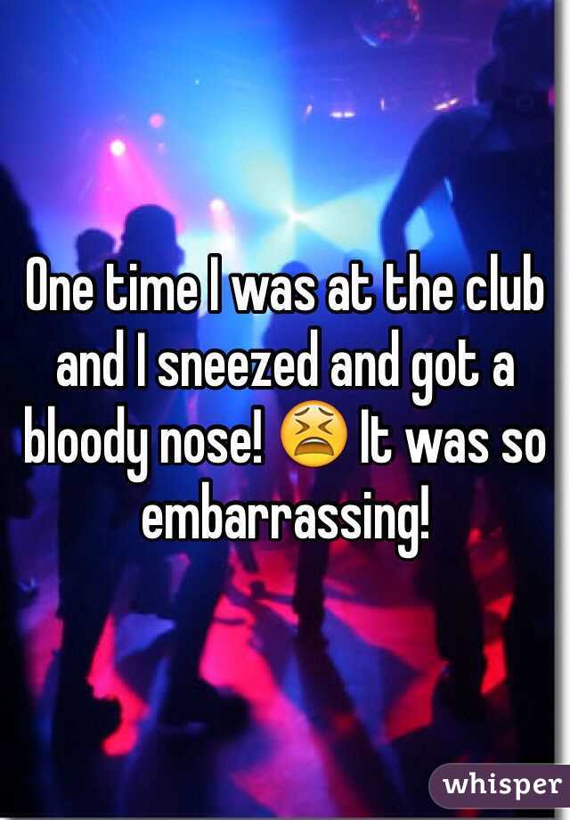 One time I was at the club and I sneezed and got a bloody nose! 😫 It was so embarrassing! 
