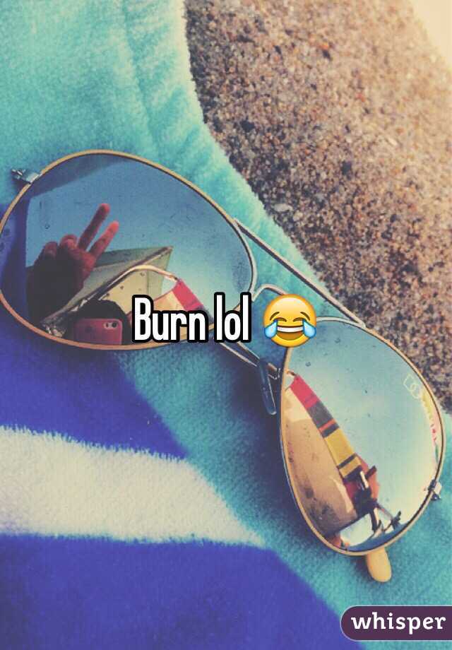 Burn lol 😂