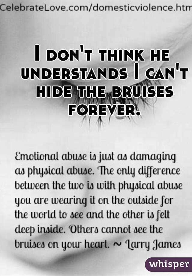 I don't think he understands I can't hide the bruises forever.