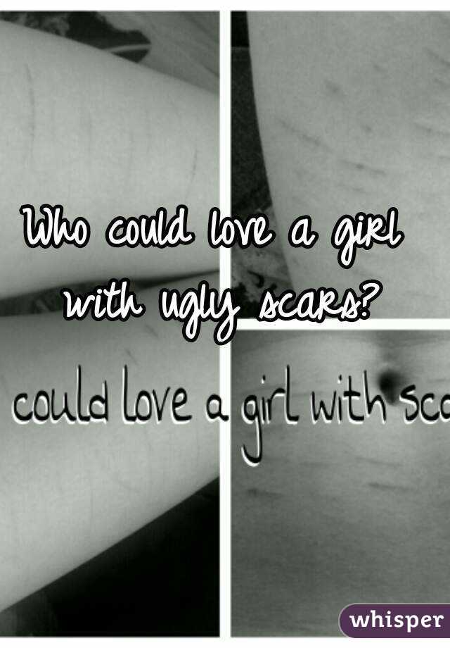 Who could love a girl with ugly scars?