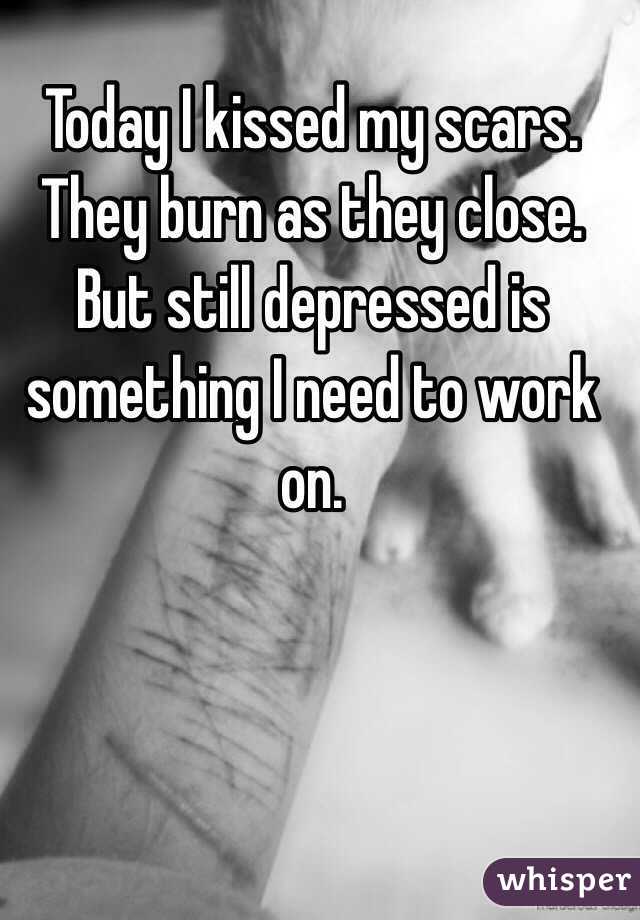 Today I kissed my scars. They burn as they close. But still depressed is something I need to work on. 