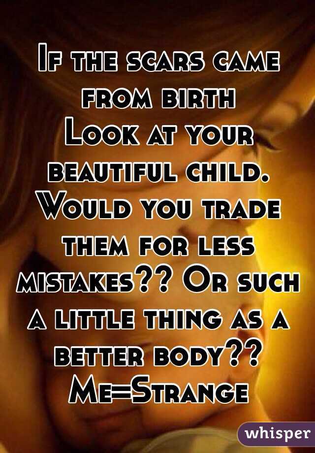 If the scars came from birth
Look at your beautiful child.
Would you trade them for less mistakes?? Or such a little thing as a better body??
Me=Strange 