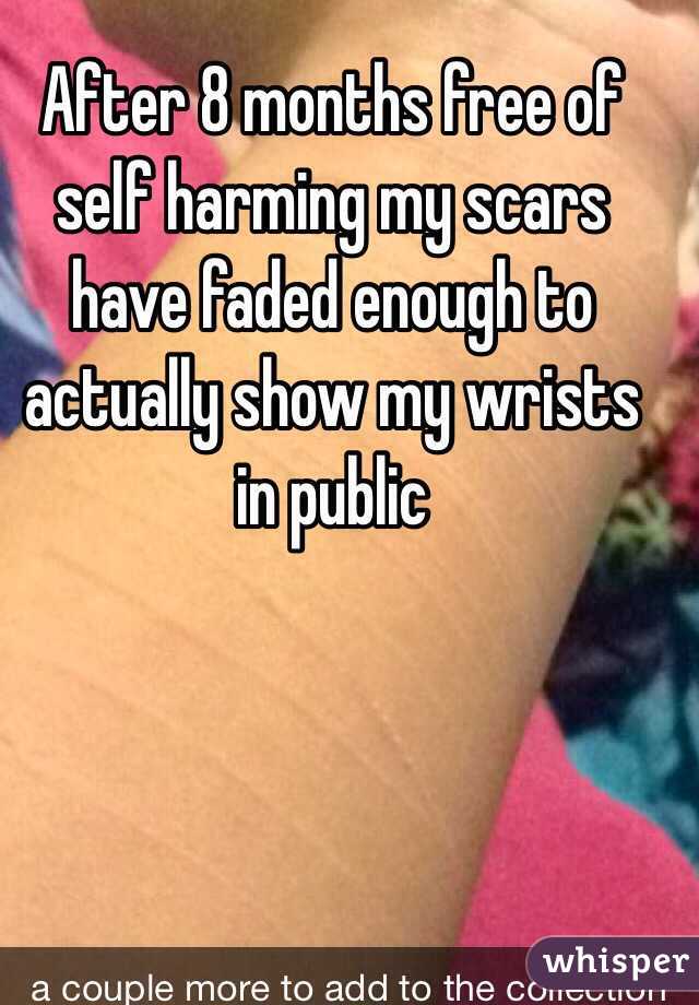 After 8 months free of self harming my scars have faded enough to actually show my wrists in public