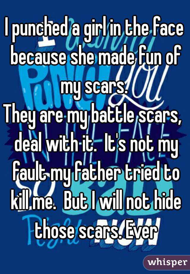 I punched a girl in the face because she made fun of my scars. 
They are my battle scars,  deal with it.  It's not my fault my father tried to kill me.  But I will not hide those scars. Ever