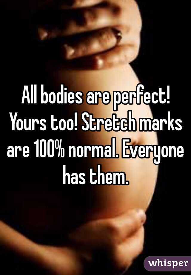 All bodies are perfect! Yours too! Stretch marks are 100% normal. Everyone has them. 