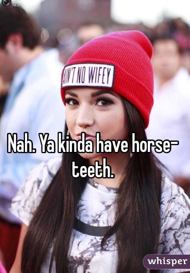 Nah. Ya kinda have horse-teeth.