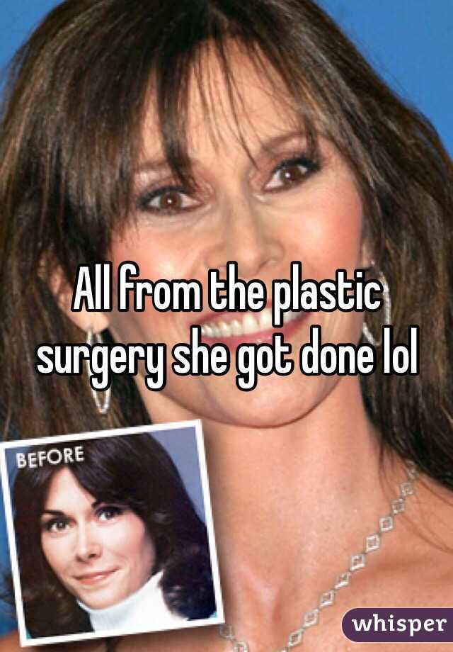 All from the plastic surgery she got done lol