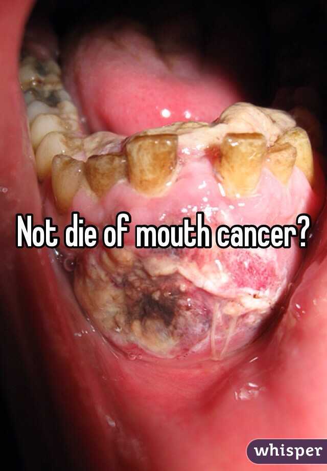 Not die of mouth cancer?