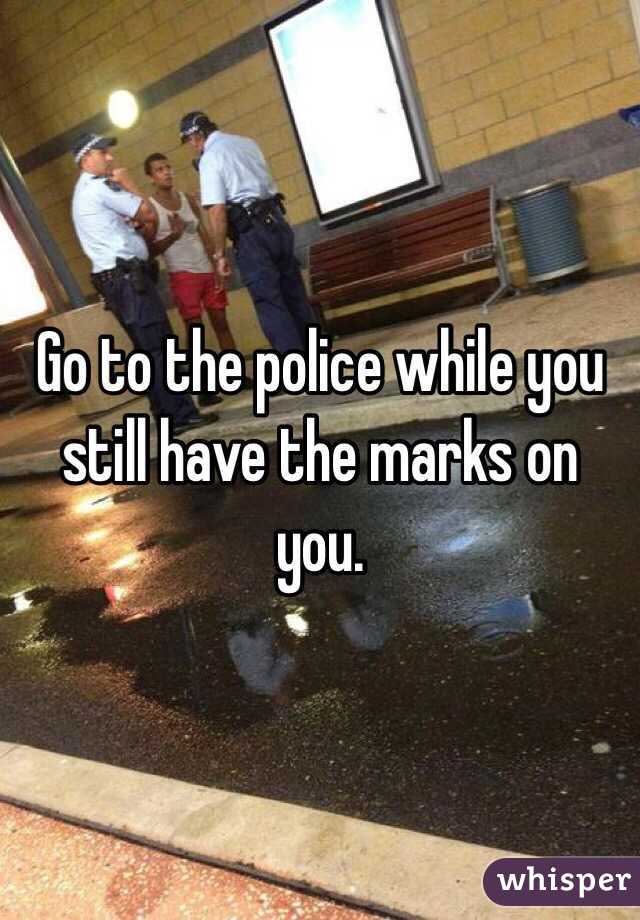Go to the police while you still have the marks on you. 