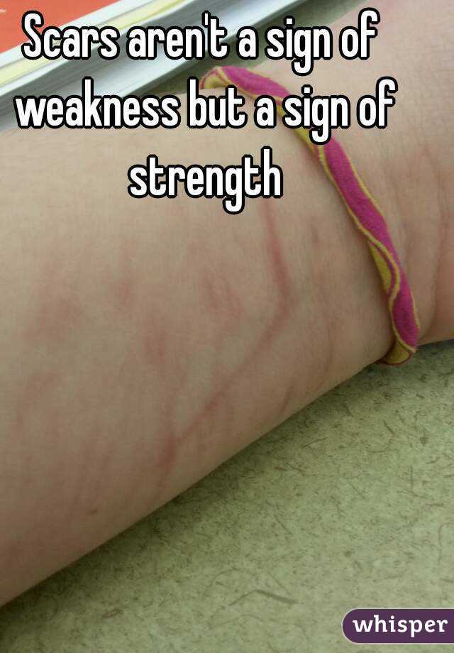 Scars aren't a sign of weakness but a sign of strength