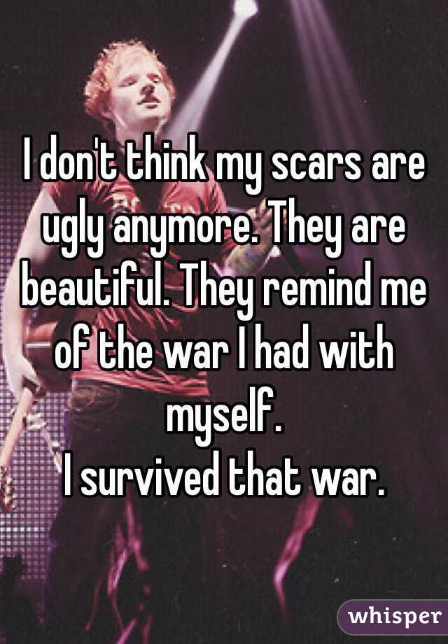 I don't think my scars are ugly anymore. They are beautiful. They remind me of the war I had with myself.
I survived that war. 