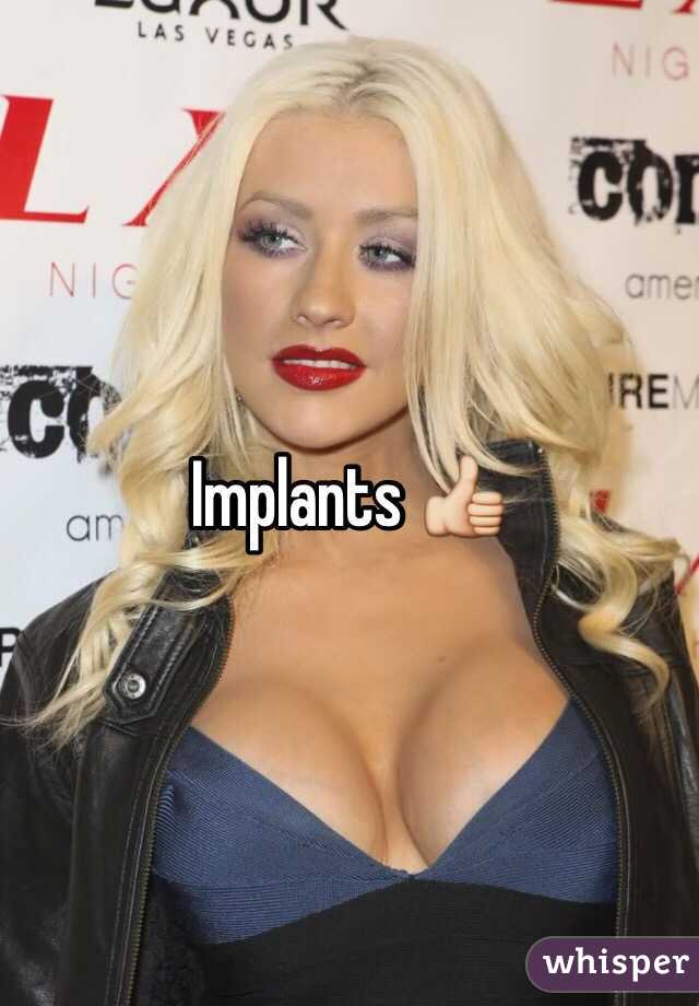 Implants 👍