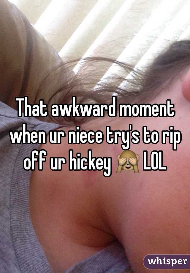 That awkward moment when ur niece try's to rip off ur hickey 🙈 LOL 