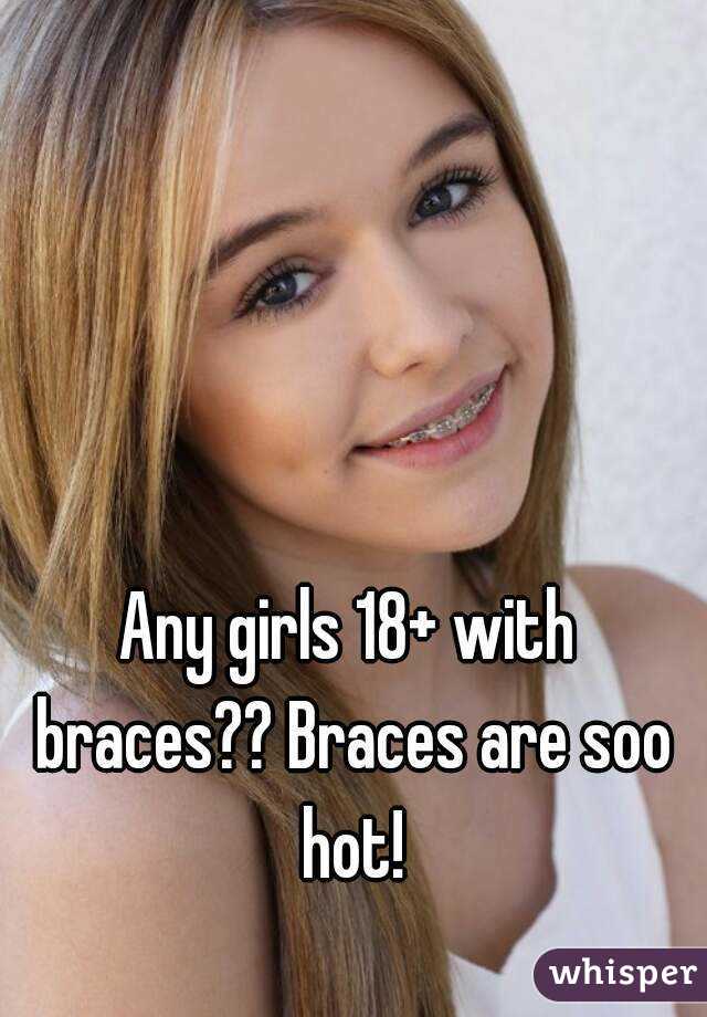 Any girls 18+ with braces?? Braces are soo hot!