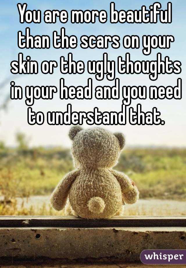 You are more beautiful than the scars on your skin or the ugly thoughts in your head and you need to understand that.