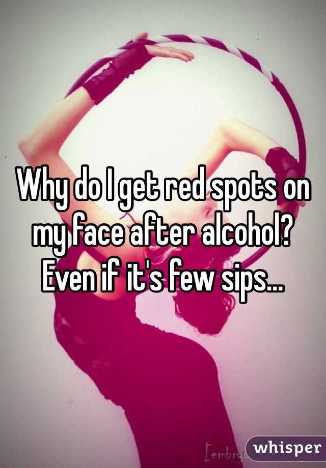 why-do-i-get-red-spots-on-my-face-after-alcohol-even-if-it-s-few-sips