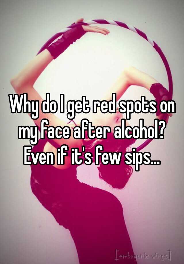 why-do-i-get-red-spots-on-my-face-after-alcohol-even-if-it-s-few-sips