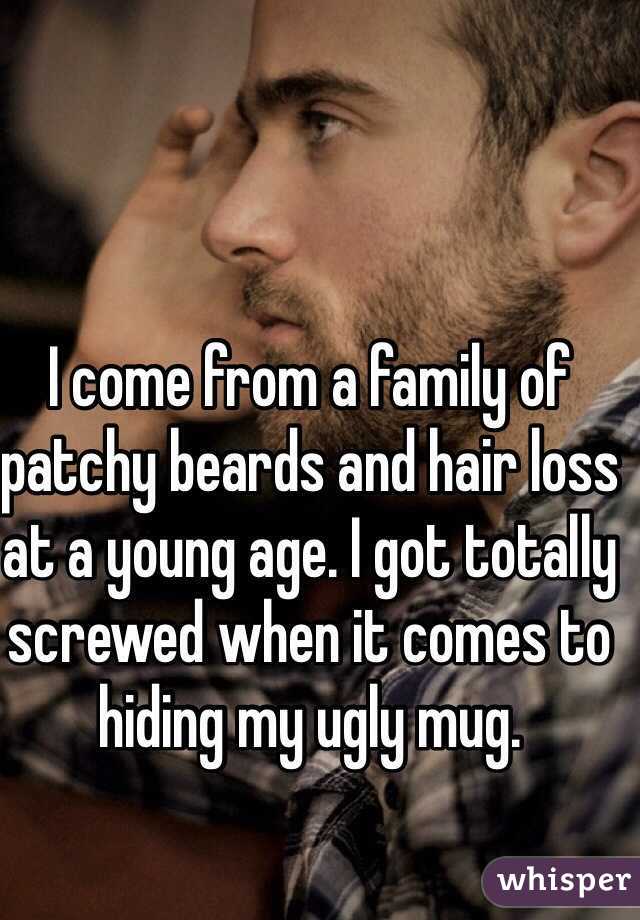 I come from a family of patchy beards and hair loss at a young age. I got totally screwed when it comes to hiding my ugly mug. 