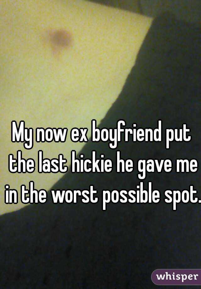 My now ex boyfriend put the last hickie he gave me in the worst possible spot.