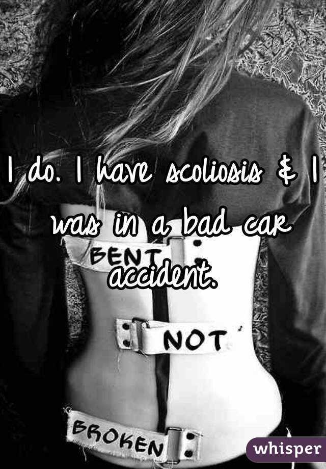 I do. I have scoliosis & I was in a bad car accident. 
