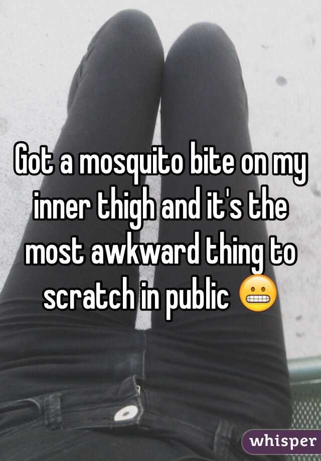 Got a mosquito bite on my inner thigh and it's the most awkward thing to scratch in public 😬