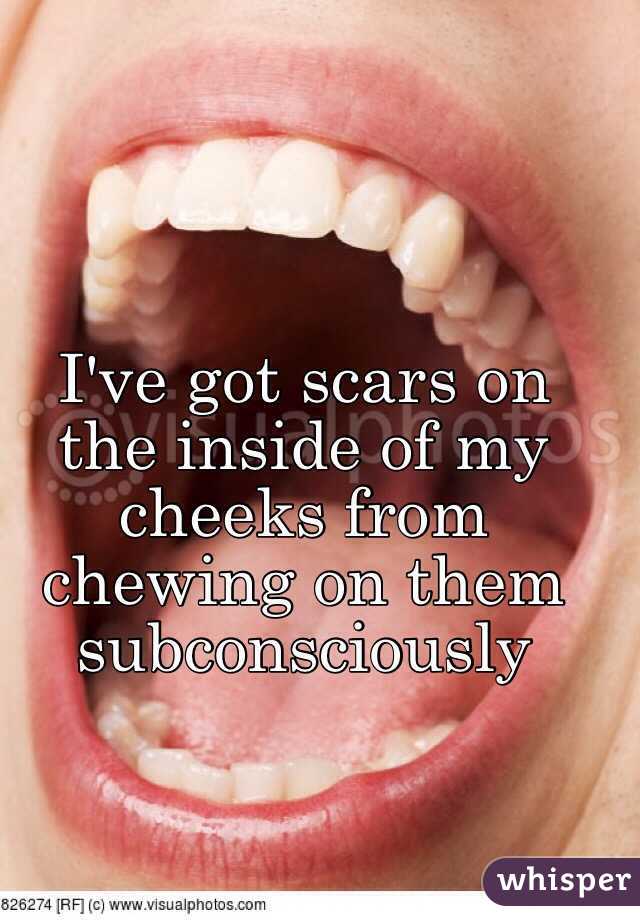 I've got scars on the inside of my cheeks from chewing on them subconsciously