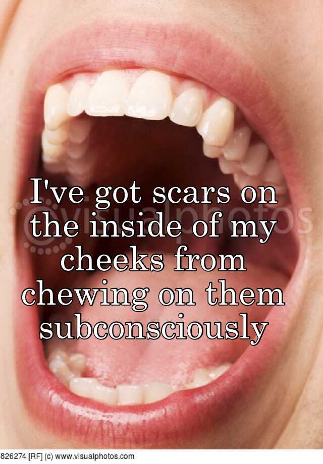 i-ve-got-scars-on-the-inside-of-my-cheeks-from-chewing-on-them