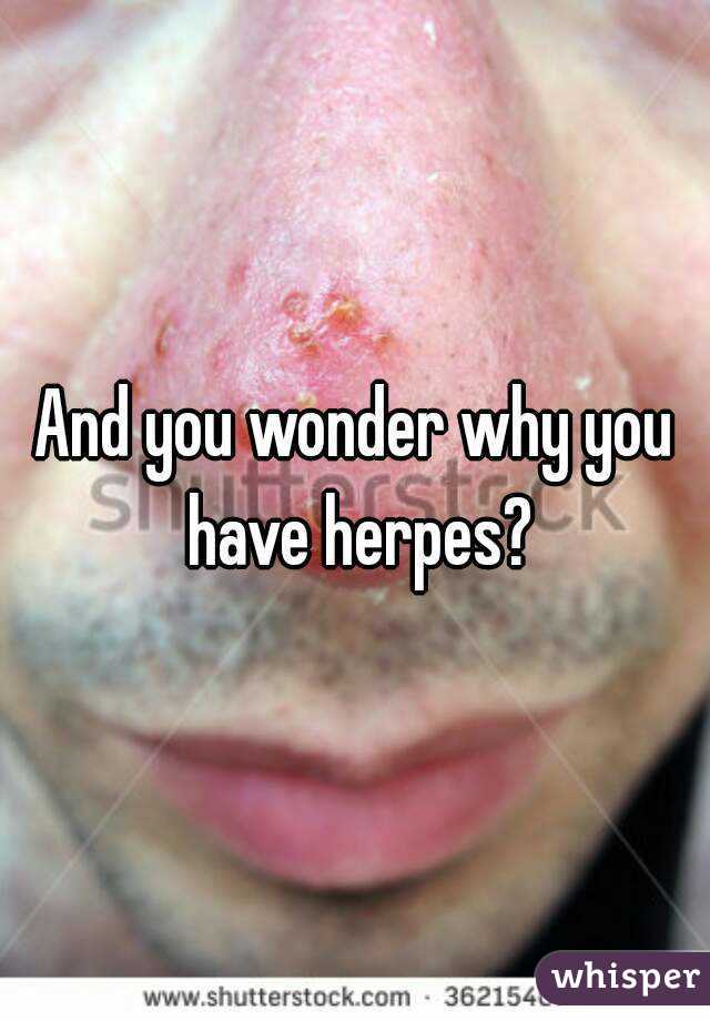 And you wonder why you have herpes?