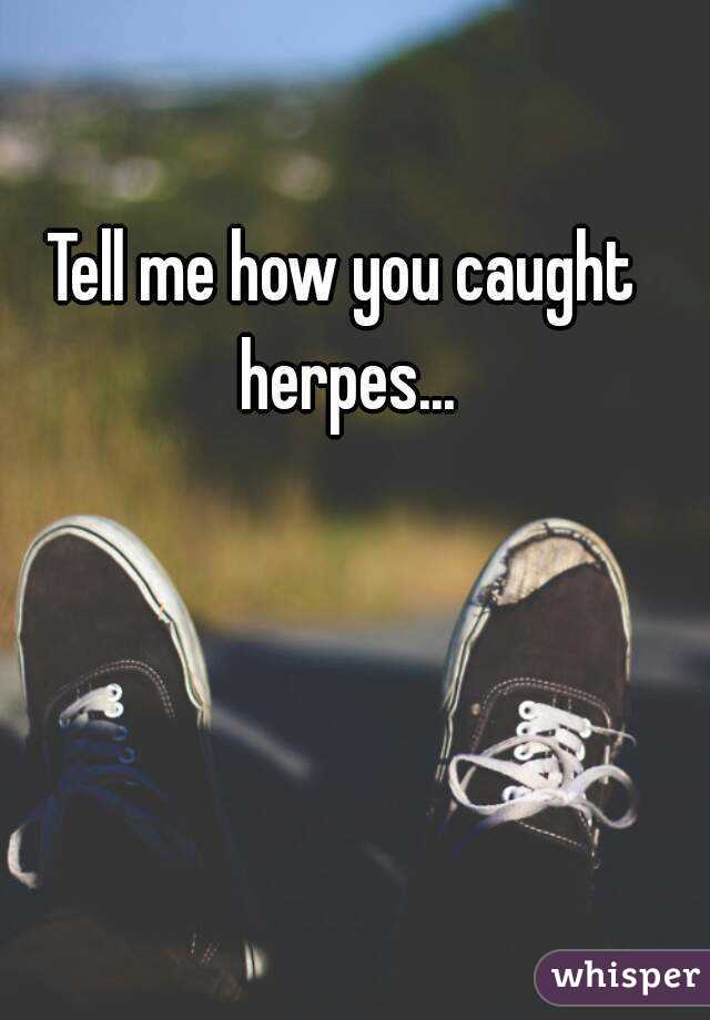 Tell me how you caught herpes...