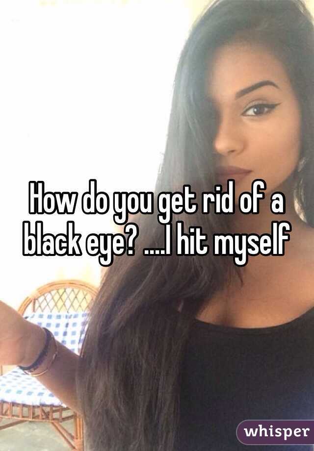 How To Get Rid A Black Eye
